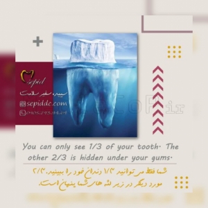 طراحی گرافیک، موشن گرافیک، انیمیشن، تیزر